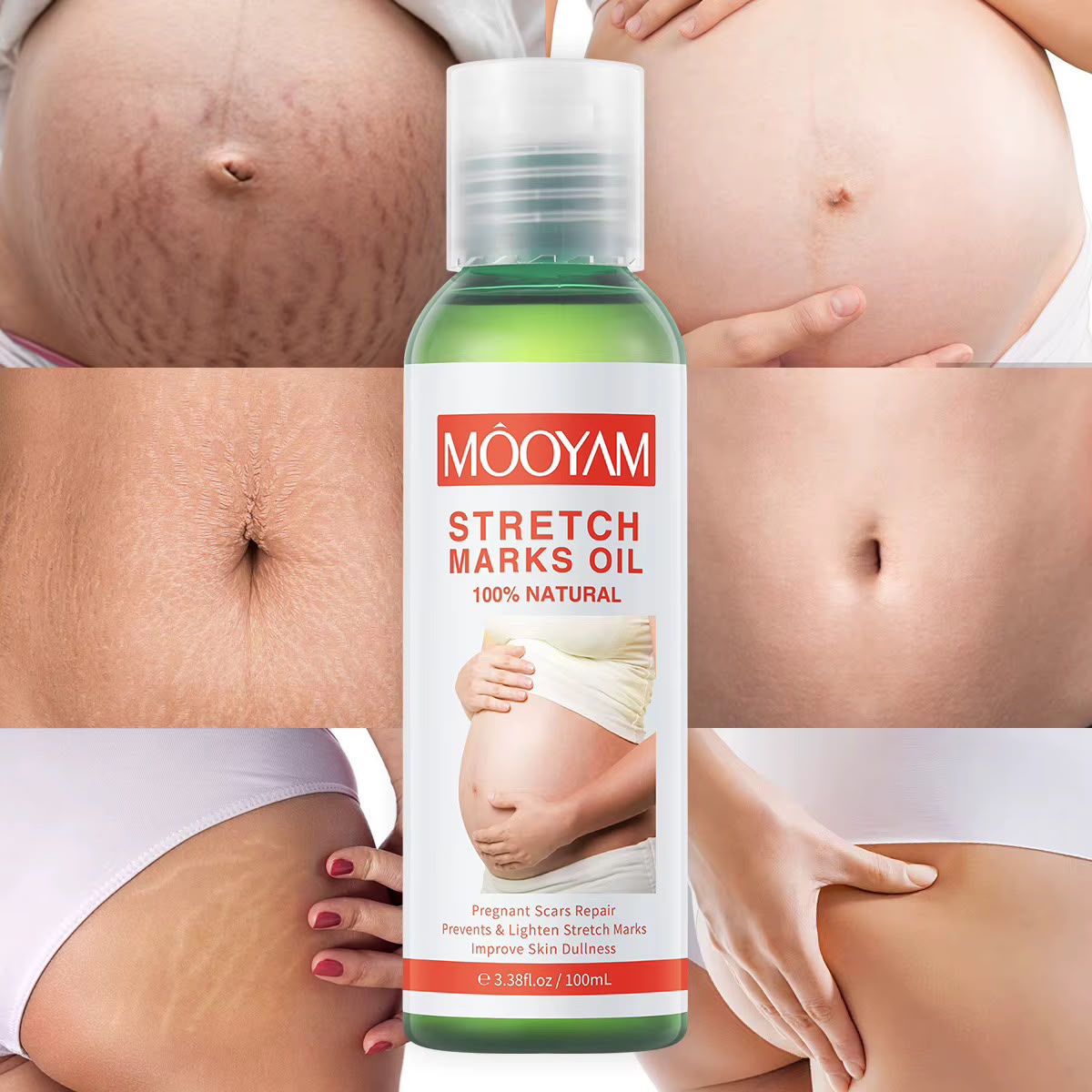 MÔOYAM Stretch Marks Oil — Huile Anti-Vergetures