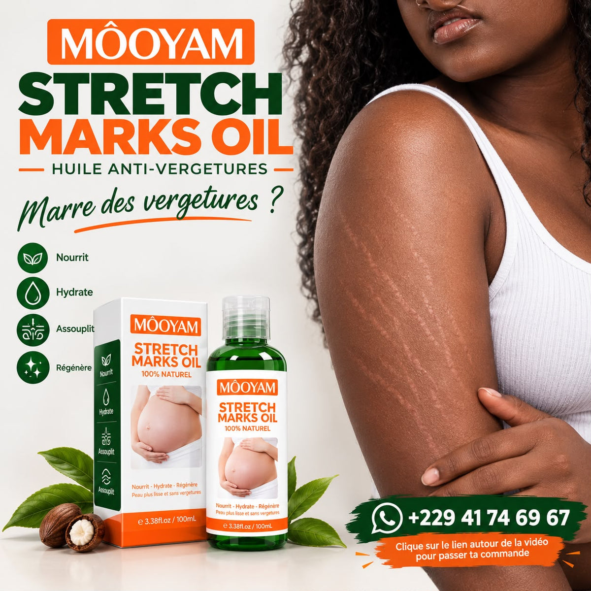 MÔOYAM Stretch Marks Oil — Huile Anti-Vergetures