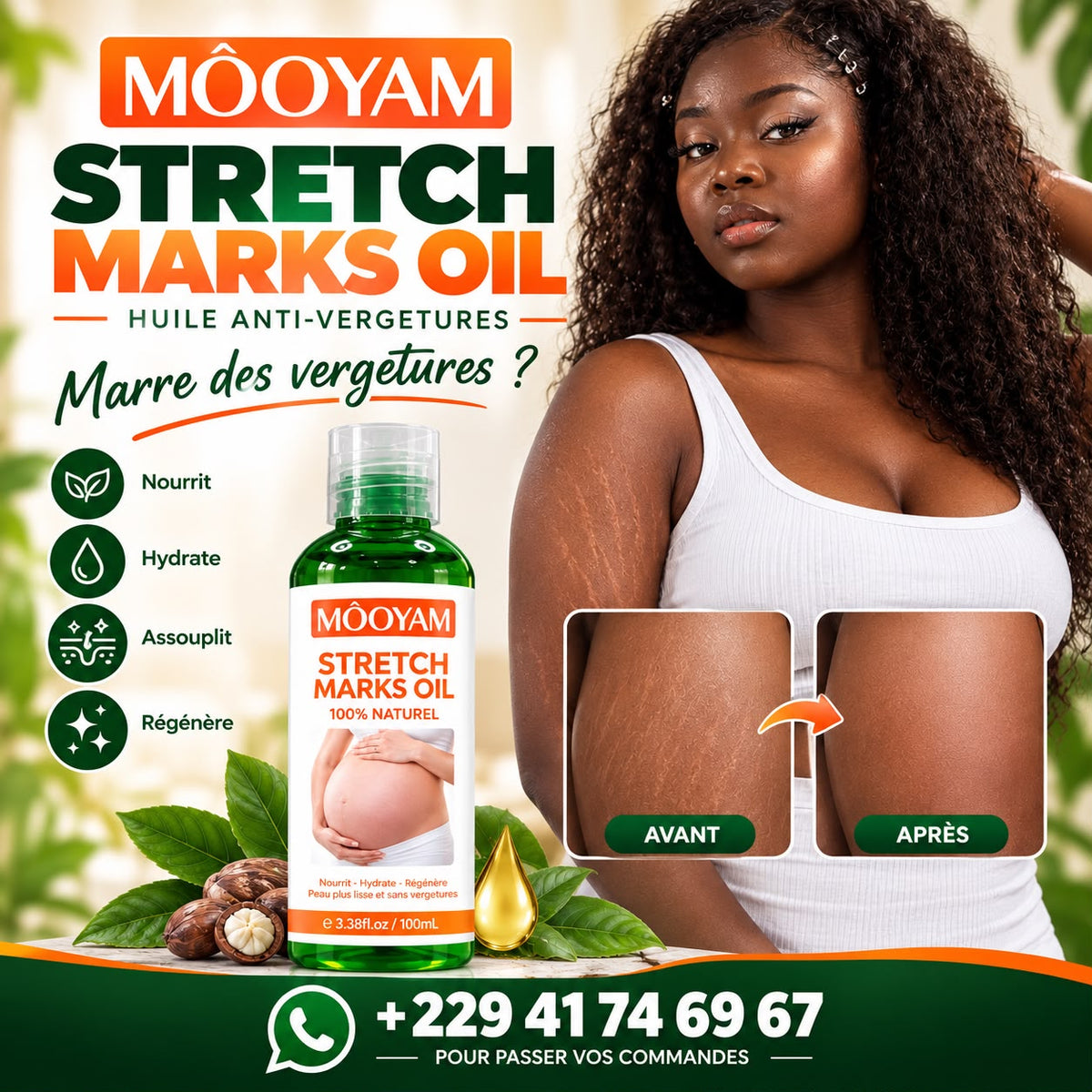 MÔOYAM Stretch Marks Oil — Huile Anti-Vergetures