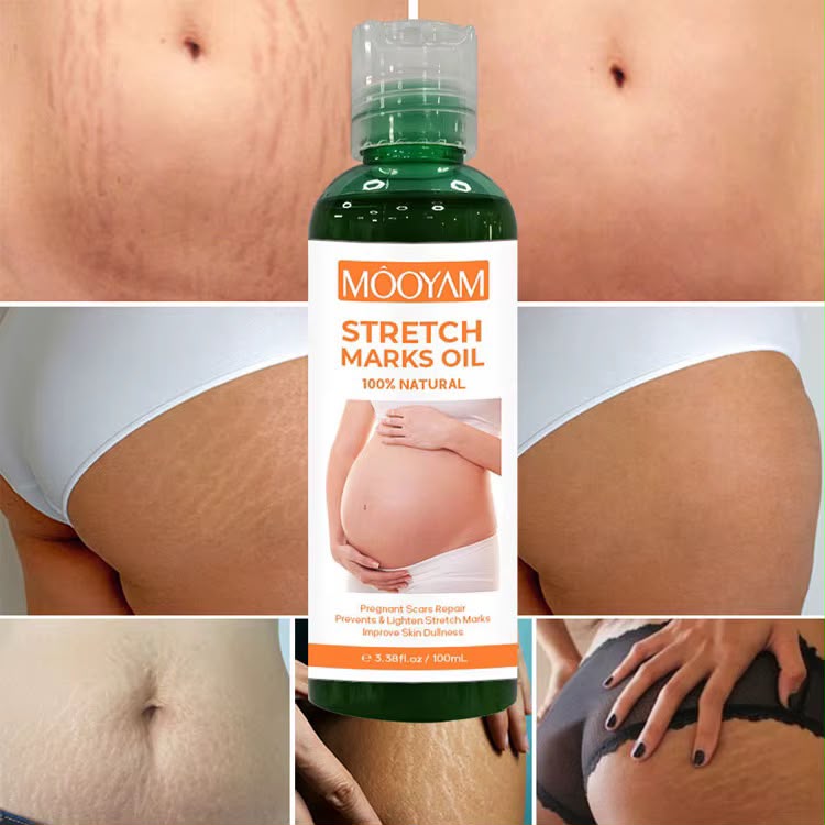 MÔOYAM Stretch Marks Oil — Huile Anti-Vergetures
